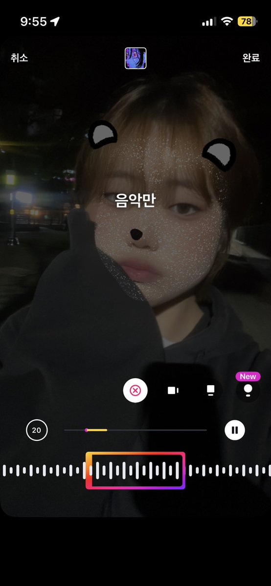 poiona2rn's tweet photo. 팔 상태 많이 좋아짐!! 근데 추우면 보라샥이고 더우면 핑크빛임ㅋㅋㅋ 나중에 타투로 가려야지
#자해 #자살 #정병 #트친소_𝕏친소 #담배 #약물자해 https://t.co/PPThWdHULP