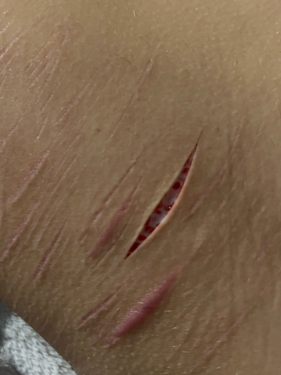 dariasarchive's tweet photo. look how good my sfx makeup is!! ALL FAKE this isn’t real!! https://t.co/sXkjfiXf8z