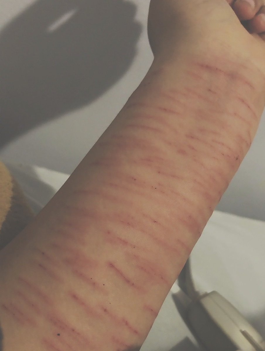 appledeerbabe's tweet photo. sfx makeup not real! #sfx #makeup #fakebody I’m doing so much today! *ೃ༄ https://t.co/auCh0BRJ5K