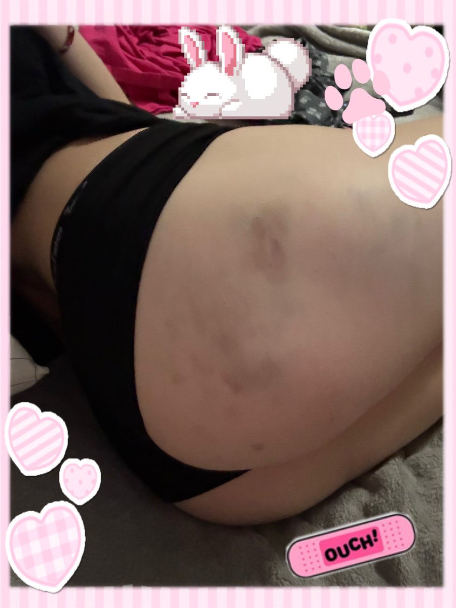 prettykitty1534's tweet photo. Bruised up from being kicked on the ground like a slut :3 #cnc #slut #nsfwtwt https://t.co/hpwsbOj1xx