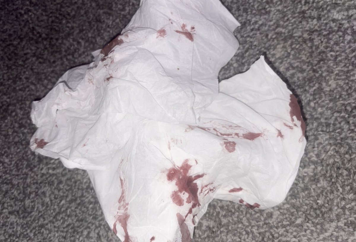 exotic_friut's tweet photo. #edrtwtㅤ #ricecaketwt #shedtwt 

got blood all over my new pants. i’m going deeper next time, im so stupid. https://t.co/cV1rzcOP6O