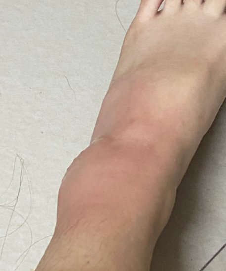 AdamGarcia98pb's tweet photo. [Every kick makes the ankle go crunch!]， https://t.co/ybKMfefKzo