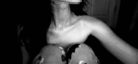exotic_friut's tweet photo. #edtwtㅤ #edrtwtㅤ #bodycheck 

🩻🩶 https://t.co/hP3W4MuTcO