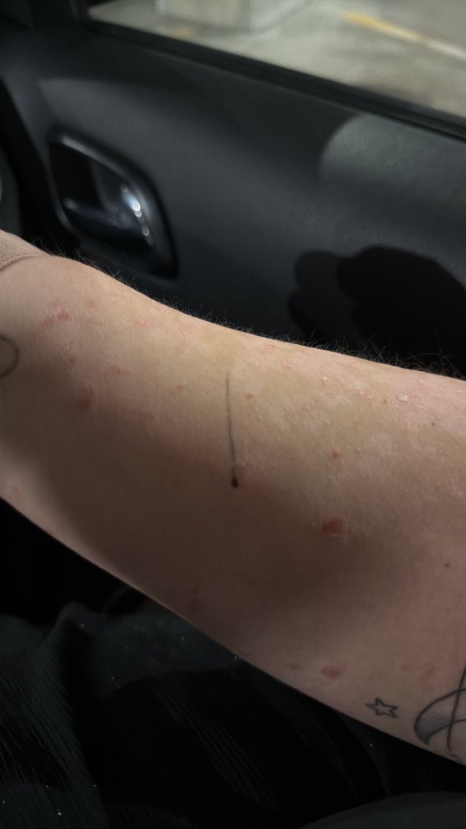 heatedphan's tweet photo. i just realized i got sharpied by dan or phil today oh my gosh https://t.co/zTzbsC6hlX