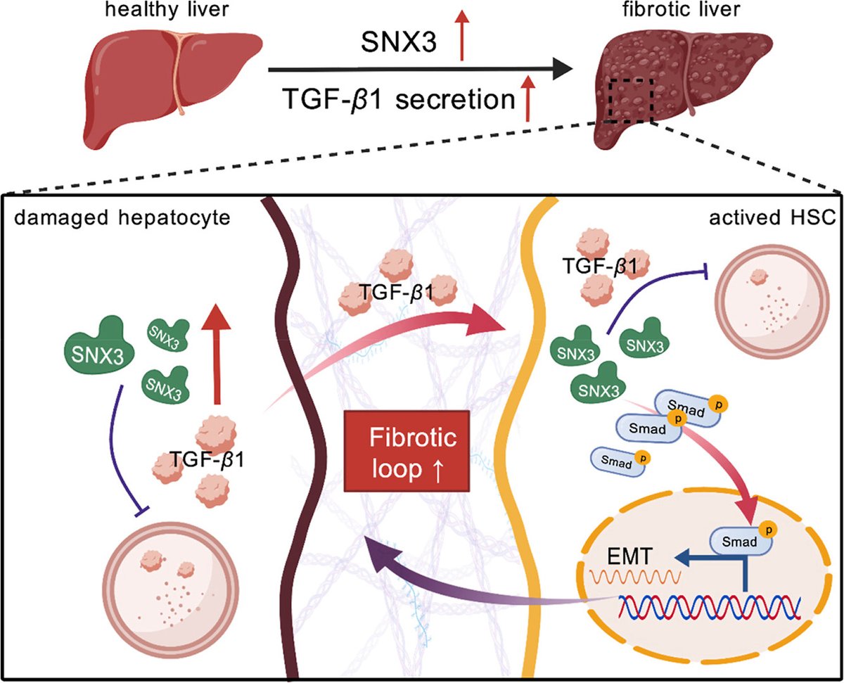 ActaPharmSinB's tweet photo. Article✍️#SNX3 exacerbates #hepatic #fibrosis by amplifying #TGF-β1/#Smad signaling pathway in #hepatocyte-#HSC #fibrotic #loop. From Dr. Liu @SunYat-senUniversity; @Sciencedirect; @ElsevierConnect.
https://t.co/4Q4n7MksN8. https://t.co/AnZ4IyMinW