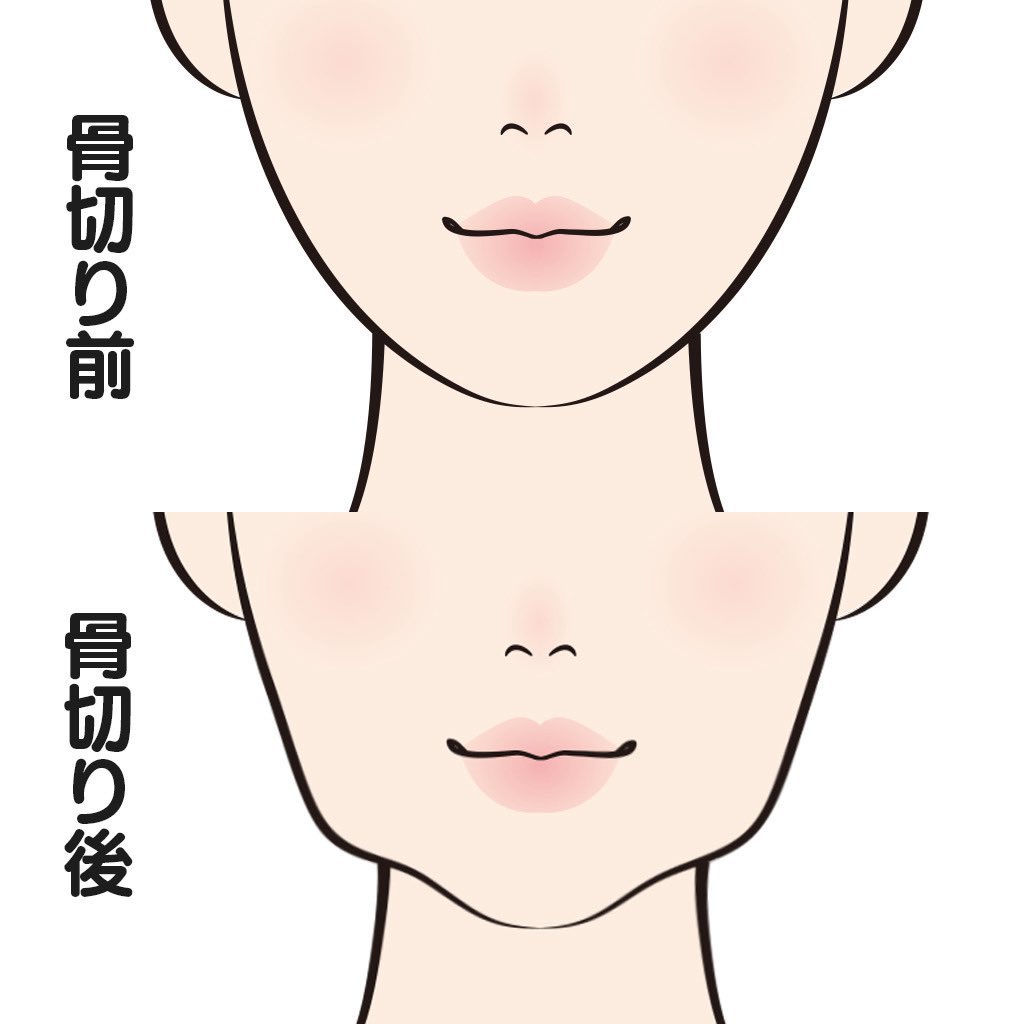 h4t2ud's tweet photo. 自分まさに典型的なコレで草　
たるみやすいのかな🤨
まぁやらなかったら一生悶々としてただろうから後悔はないぞ‼️ https://t.co/G1En3Psg7O