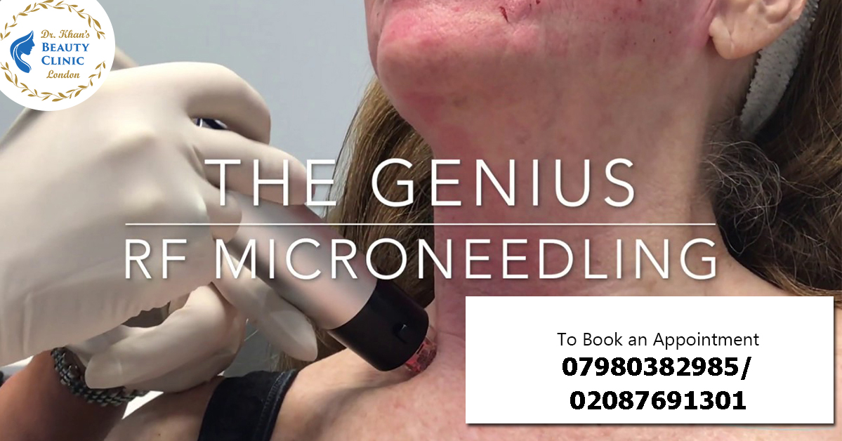 DrKhansBeautyC1's tweet photo. Transform your neck with RF gold plated #microneedling!
This innovative #treatment rejuvenates #skin, reduces fine lines & enhances your natural #beauty.
Embrace a smoother, youthful appearance today!
☎️07980382985/02087691301
🌐https://t.co/Ig9eJEG34p
#GoldRF #RFMicroneedling https://t.co/jw6SOrV24P