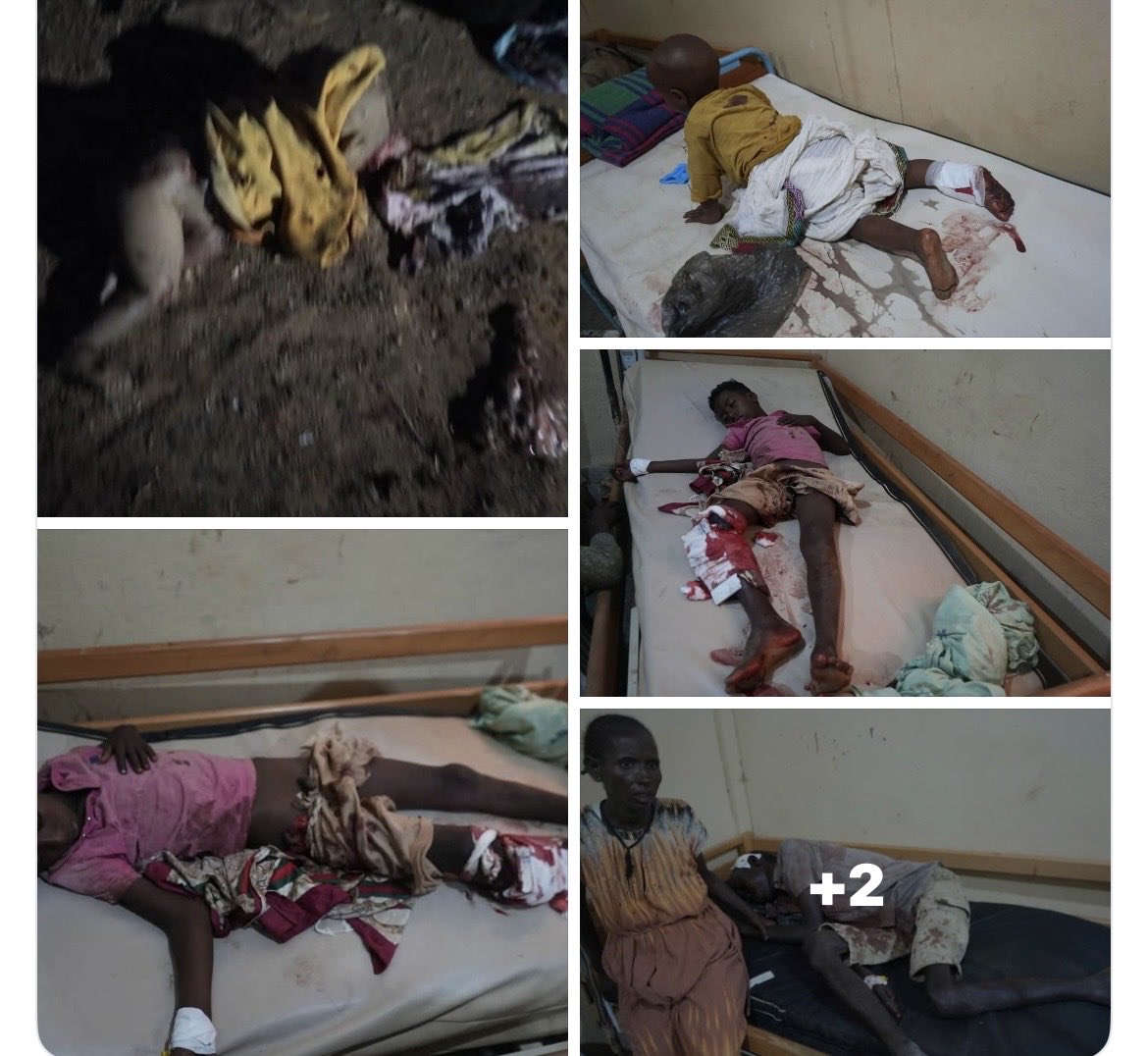 MizerTigrewayti's tweet photo. We will never normalize the bombing of civilians.

#StopBombingTigray
@UNHumanRights @UN_HRC https://t.co/8UrLcwD2xr