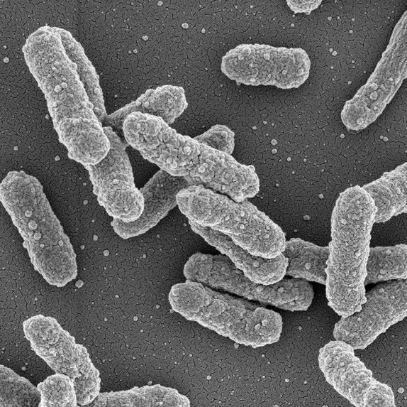 updatecharts's tweet photo. Uma pesquisadora morreu após um possível vazamento em um laboratório russo, levando as autoridades de saúde a colocarem centenas de pessoas em quarentena devido à SUSPEITA de PESTE PNEUMÔNICA.

Vários hospitais também foram fechados e colocados em QUARENTENA. https://t.co/BOTUrp8S2u