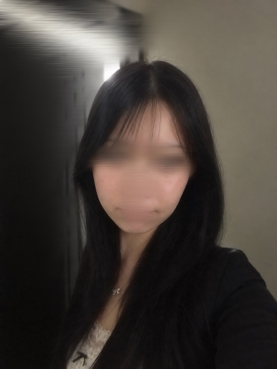 6a6y11_'s tweet photo. シャープ美容外科（@sharpps_jp）で脂肪吸引➕脂肪再配置➕目の下の脂肪再配置をして1ヶ月経ちました🪽周りから顔小さくなった？と言ってもらえることが増えてすごく嬉しいです😭✨️ https://t.co/1NnmFjJsA5