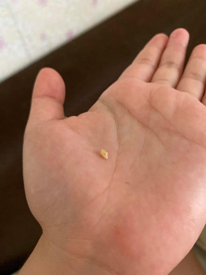 cbexytw's tweet photo. Ini bau nya busuk sekali 
KLO Uda kluar ini nafas jadi seger bau mulut hempasss
Aku pakek alat ini buat ngeluarin itu
📎https://t.co/c9GrsgXB3c
🖇️https://t.co/c9GrsgXB3c https://t.co/92cJ7o3eXp