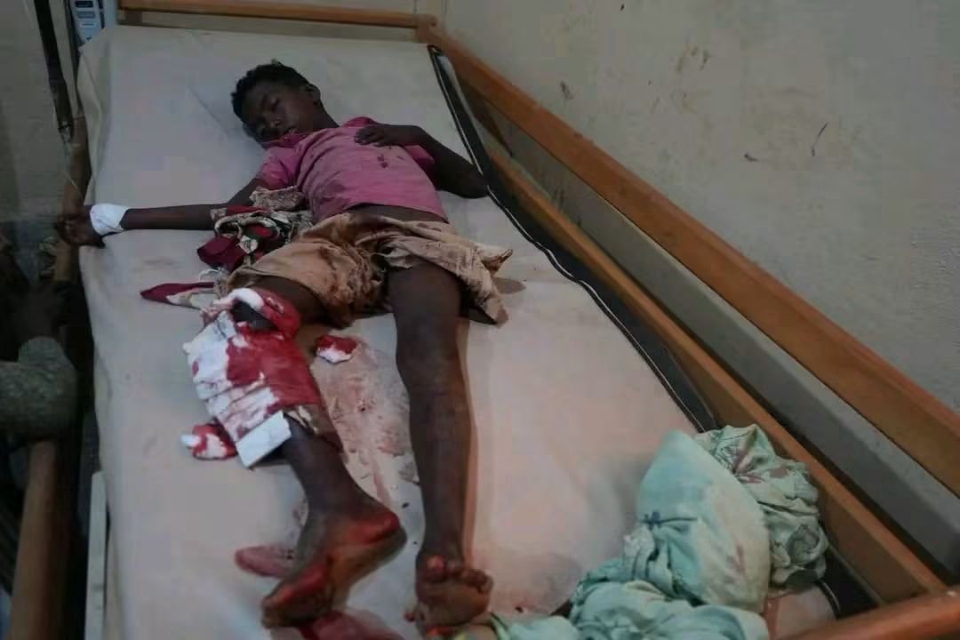 DadeDesta's tweet photo. Abiy Ahmed’s drones struck the IDP camps in Sheraro again last night, reportedly killing nine civilians, including a child, and injuring six others.
The conduct of Abiy Ahmed’s government increasingly defies the basic norms expected of a state. Civilians and civilian infrastructure appear repeatedly in the line of fire.
What makes this even more tragic is that the world knows these attacks are happening, yet meaningful international action remains painfully absent.
The war launched in 2020 displaced these people from their homes and forced many of them to spend more than five years in IDP camps. Now, even those camps offer no refuge. People who fled violence and lost their homes are being subjected to missiles and bombs in the very places where they sought safety.
And when the camps themselves are not struck, humanitarian relief and the routes needed to deliver food and essential supplies have also faced attack and disruption.
The pattern deserves urgent international scrutiny, independent investigation, accountability, and protection for civilians. Allegations of genocidal acts and other grave violations cannot simply be met with silence.
These victims are not statistics. They are civilians who have already endured years of displacement, deprivation, and war.
Their lives matter. Their suffering should not be treated as though it is happening on another planet.