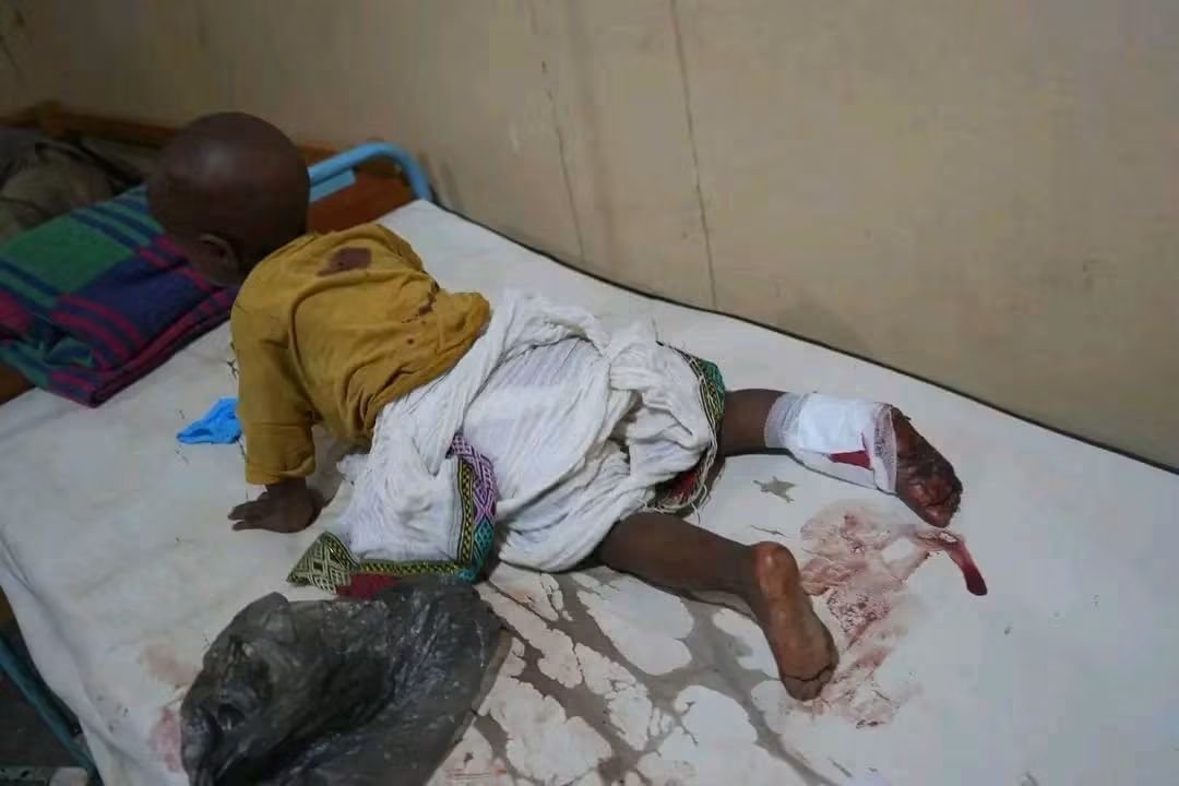 DadeDesta's tweet photo. Abiy Ahmed’s drones struck the IDP camps in Sheraro again last night, reportedly killing nine civilians, including a child, and injuring six others.
The conduct of Abiy Ahmed’s government increasingly defies the basic norms expected of a state. Civilians and civilian infrastructure appear repeatedly in the line of fire.
What makes this even more tragic is that the world knows these attacks are happening, yet meaningful international action remains painfully absent.
The war launched in 2020 displaced these people from their homes and forced many of them to spend more than five years in IDP camps. Now, even those camps offer no refuge. People who fled violence and lost their homes are being subjected to missiles and bombs in the very places where they sought safety.
And when the camps themselves are not struck, humanitarian relief and the routes needed to deliver food and essential supplies have also faced attack and disruption.
The pattern deserves urgent international scrutiny, independent investigation, accountability, and protection for civilians. Allegations of genocidal acts and other grave violations cannot simply be met with silence.
These victims are not statistics. They are civilians who have already endured years of displacement, deprivation, and war.
Their lives matter. Their suffering should not be treated as though it is happening on another planet.