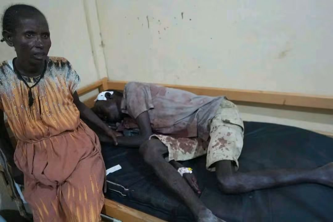 DadeDesta's tweet photo. Abiy Ahmed’s drones struck the IDP camps in Sheraro again last night, reportedly killing nine civilians, including a child, and injuring six others.
The conduct of Abiy Ahmed’s government increasingly defies the basic norms expected of a state. Civilians and civilian infrastructure appear repeatedly in the line of fire.
What makes this even more tragic is that the world knows these attacks are happening, yet meaningful international action remains painfully absent.
The war launched in 2020 displaced these people from their homes and forced many of them to spend more than five years in IDP camps. Now, even those camps offer no refuge. People who fled violence and lost their homes are being subjected to missiles and bombs in the very places where they sought safety.
And when the camps themselves are not struck, humanitarian relief and the routes needed to deliver food and essential supplies have also faced attack and disruption.
The pattern deserves urgent international scrutiny, independent investigation, accountability, and protection for civilians. Allegations of genocidal acts and other grave violations cannot simply be met with silence.
These victims are not statistics. They are civilians who have already endured years of displacement, deprivation, and war.
Their lives matter. Their suffering should not be treated as though it is happening on another planet.