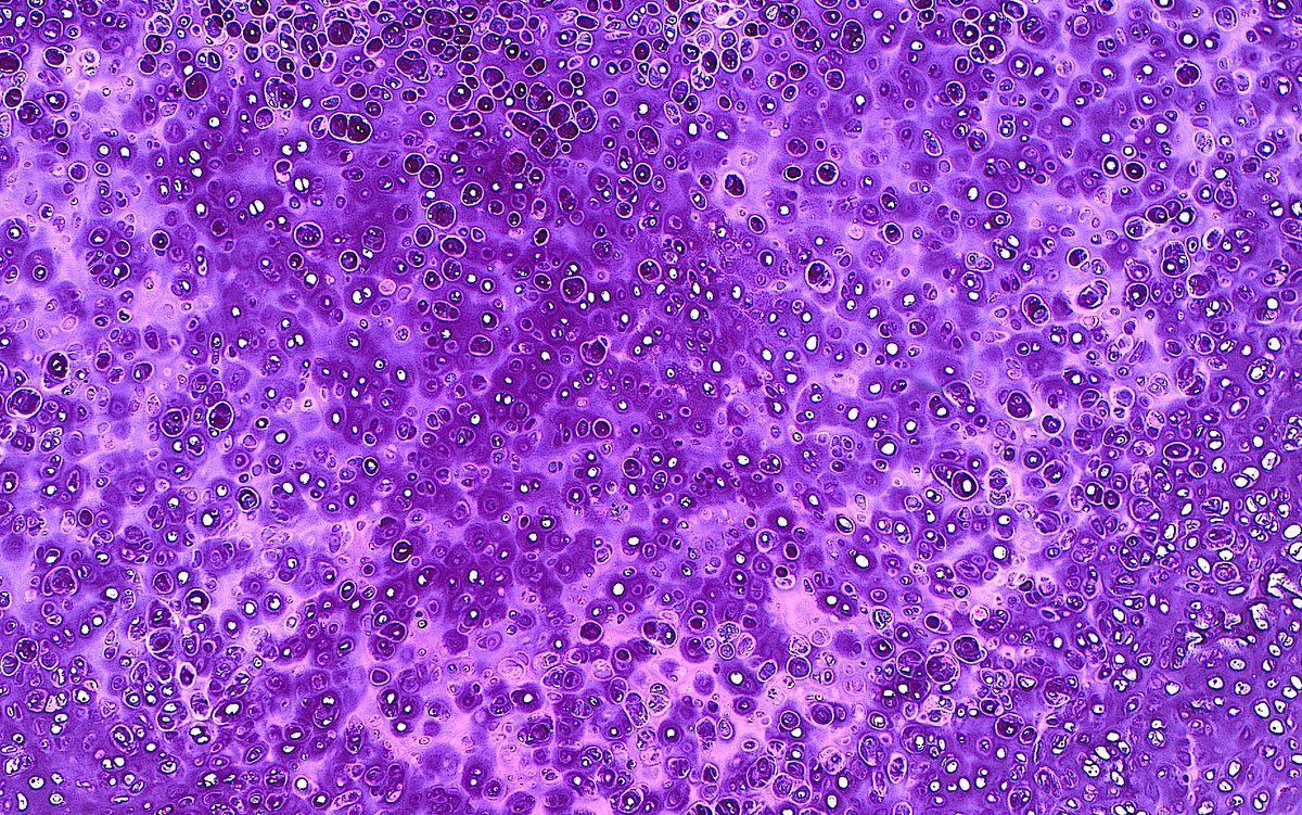 ziad_zaatari's tweet photo. π¬πΈ "A Bubbly Purple Sea" ~ The beauty of hyaline cartilage ~ #Pathology #Histology #PathArt https://t.co/ZxfKa5k3N1