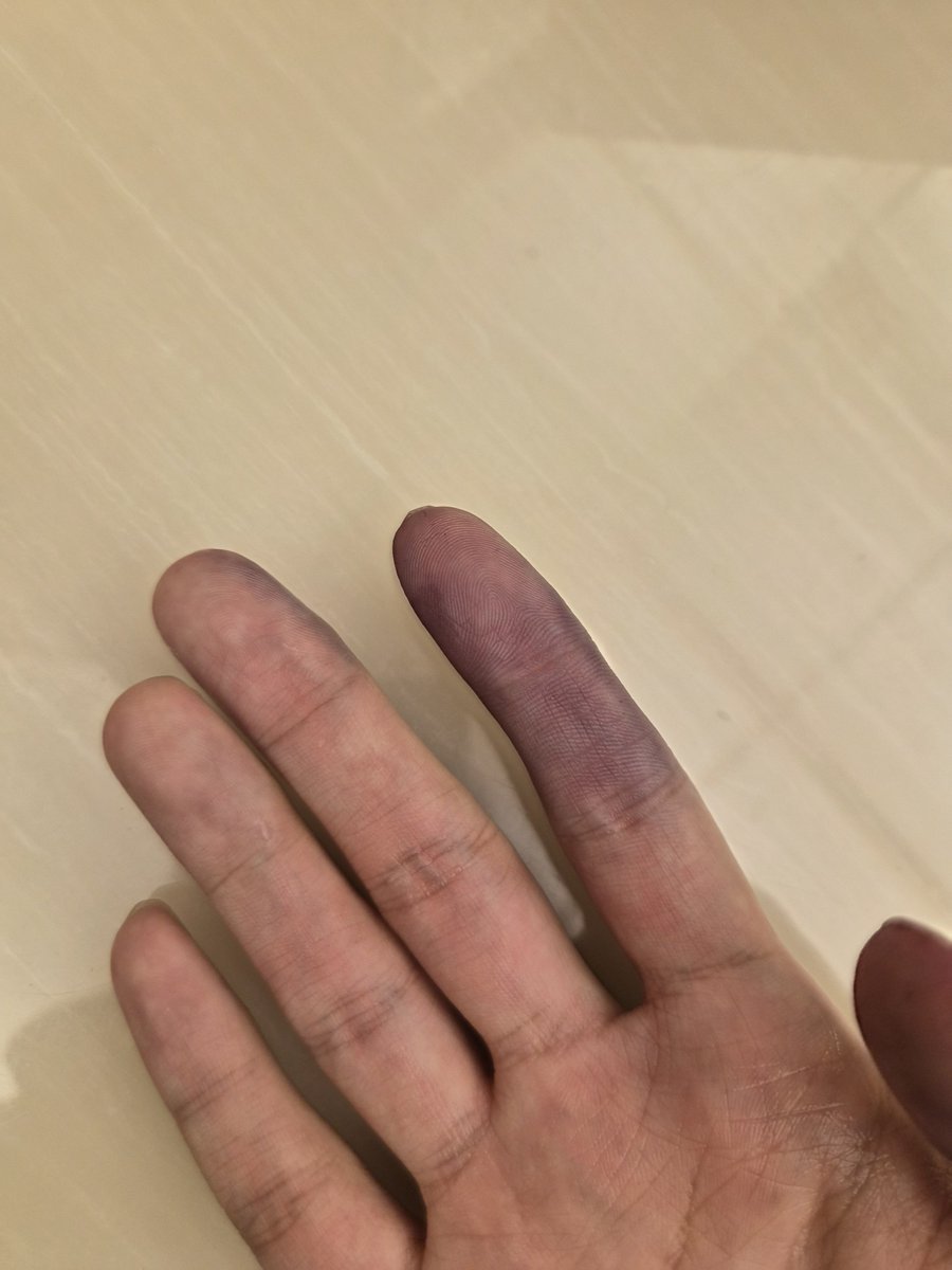 huenyang2's tweet photo. 아 휴닝카이 블루베리 먹고 멤버들한테 멍들었다고 장난치는 ㄹㅈㄷ 전기고문짓 함
개웃기게 진심 https://t.co/PjXWdcoWK8