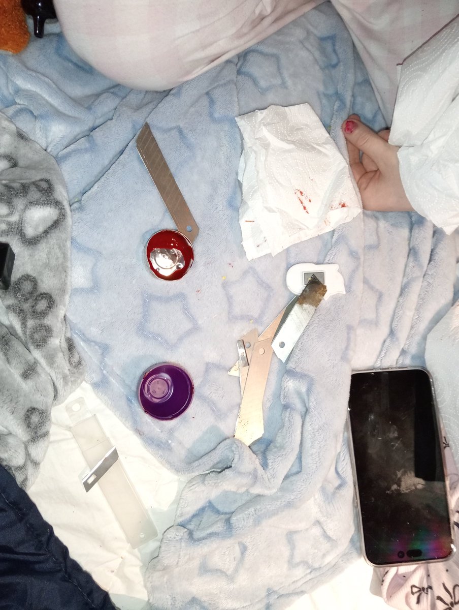 Bladestorekitty's tweet photo. Me and my roomate had a slash sesh!! (⁠人⁠*⁠´⁠∀⁠｀⁠)⁠｡⁠*ﾟ⁠+ (Only got to catscratches and styro 😒)

ALL FAKE ALL SFX MAKEUP, ALL AI.

#shedtwt #ouchietwt #sh #shtwt #slittwt #bloodtwt https://t.co/dIOhM7P9an