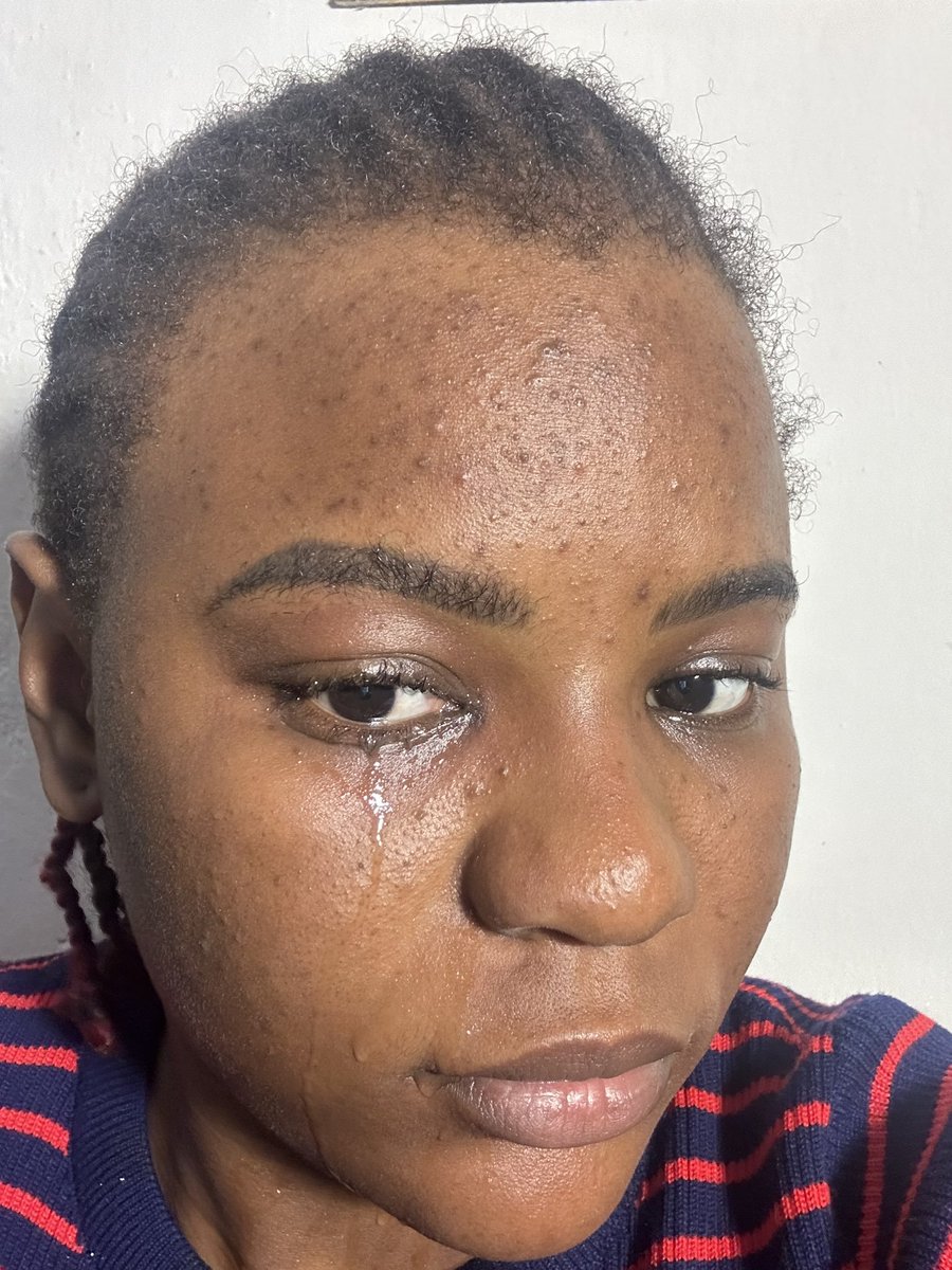 Pellerfam_'s tweet photo. Good morning Pellerians

God punish caterdogs 😒
God punish @it_Rutie 😒
God punish the foolish OS TOTo babe😒
#fyp https://t.co/ShyWaK4mao