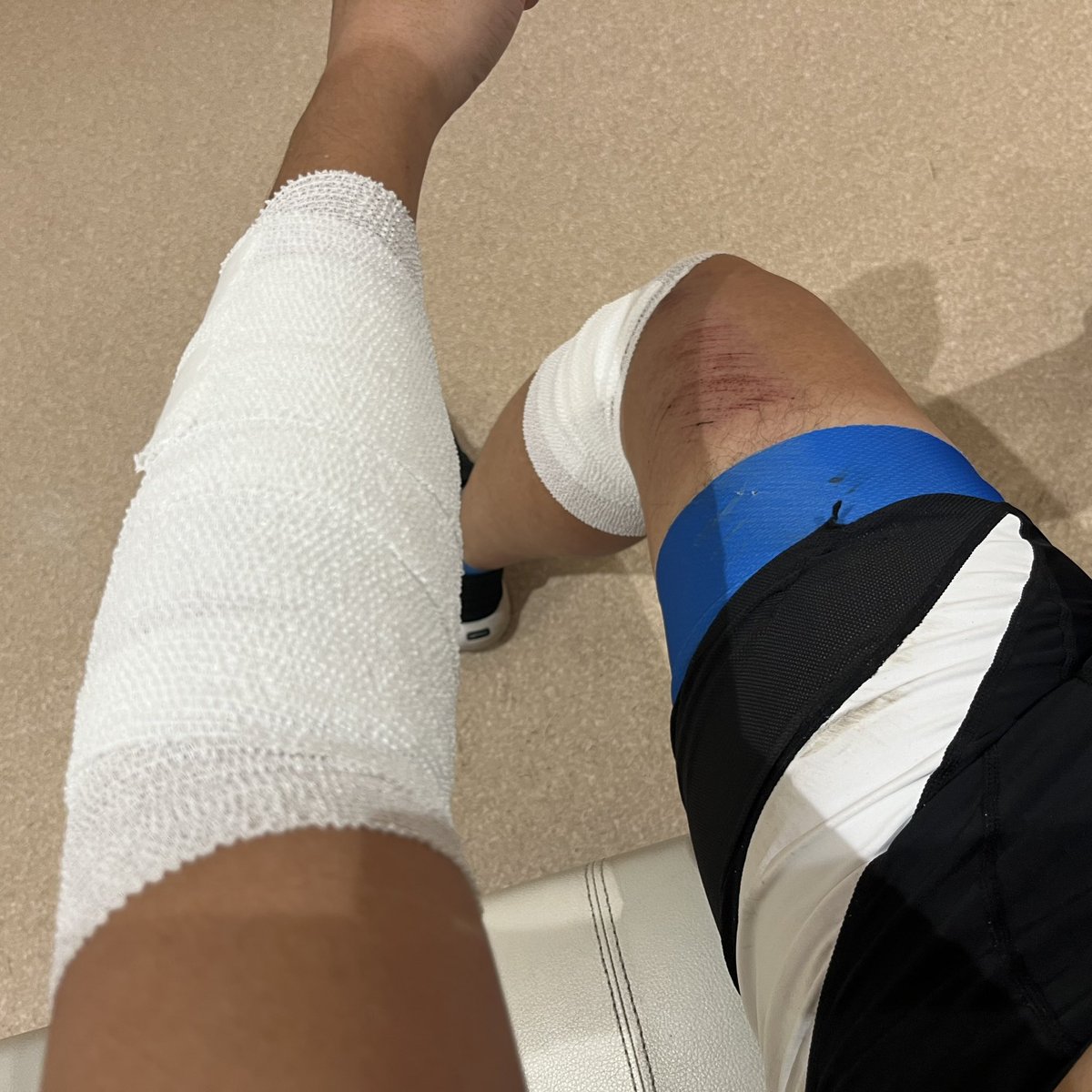 gonzalez0705's tweet photo. シーズン最終戦はレース最終盤での落車に巻き込まれ転倒する形で終わりました。
ヘルメットもチャリも無事だったのが不幸中の幸い。
（なんとなく悔しくて、曲がったハンドルをぐいっと直して完走だけしました。）

最近では擦過傷に消毒液は使わないんですね。初めて知りました。 https://t.co/4ocJoJ0s5m