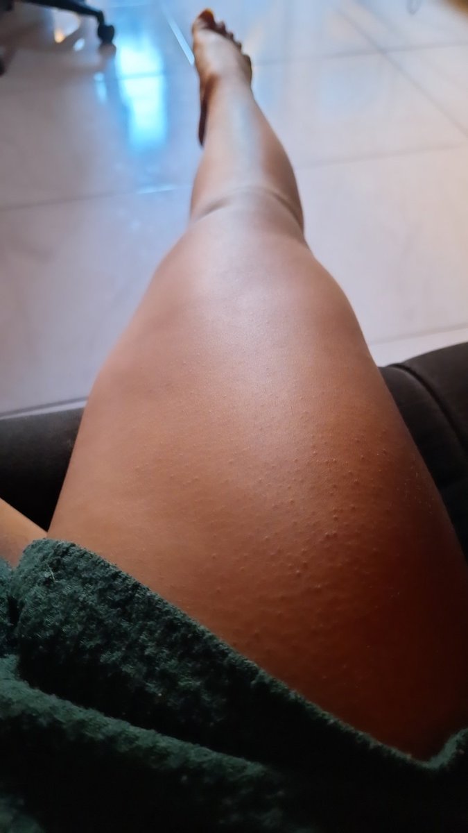 smorcegona's tweet photo. coxinha 

#feetfetısh #feetworshi̇p #feetfetısh #pezinhos #solinhas #pés https://t.co/fzirzQgXMg