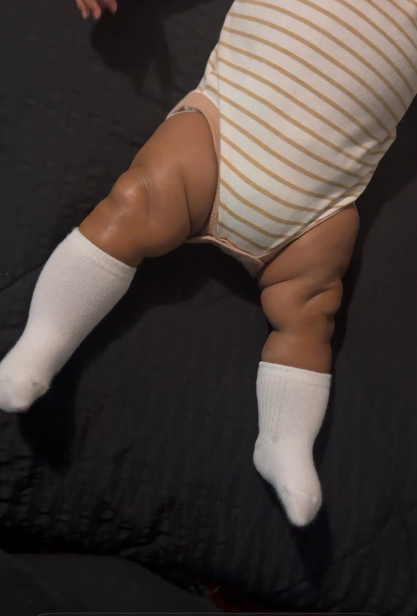 cutiewontmiss's tweet photo. I go to pick my son up from his grandparents house. Why did my mom have my baby socks pulled up to his knee caps like compression socks 🤦🏽‍♀️ lol￼ https://t.co/89ynBWb8JI