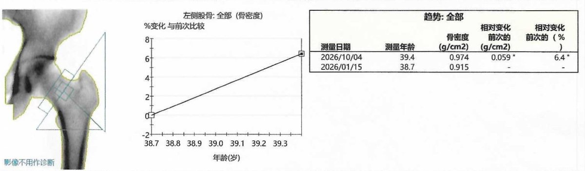 coolish's tweet photo. DEXA / DXA（双能X线扫描）是检测身体
体脂率、肌肉量、尤其骨密度的临床标准（图4）。
是高端家用8电极体脂秤、Inbody也无法代替的。

今年1月我发了下方引用推，关于
“骨骼健康重要，但被普遍低估的底层逻辑”。
当时做了一次DEXA检测，
对下肢的骨密度不太满意。

后来因为卧推受伤，
所以我3月开始打网球，至今半年，周均3小时，
减少约2/3的上肢无氧训练。
这还改善了睡眠，也把Whoop抗衰指标填上了：
https://t.co/3a8dqvawuF

昨天10月4日我再检测，骨骼改善效果相当明显：
髋部股骨骨密度 +6.4% （图1）；
年龄增加，但全身骨密度不仅没流失，还小幅增加；
内脏脂肪 398g➡️355g，-10.8%

相当于这半年，我用自己身体实验，
完全验证了⬇️引用推里，
关于优化骨骼方法的第5~7层理论。

下半身的骨骼质量
≈
下半生的腿脚好不好，还能不能活蹦乱跳

这么长期一举多得的事情，得保持做。
接下来要再接再厉，把网球常年打下去，
并且每年做一次DEXA，用科学数据指导行为。