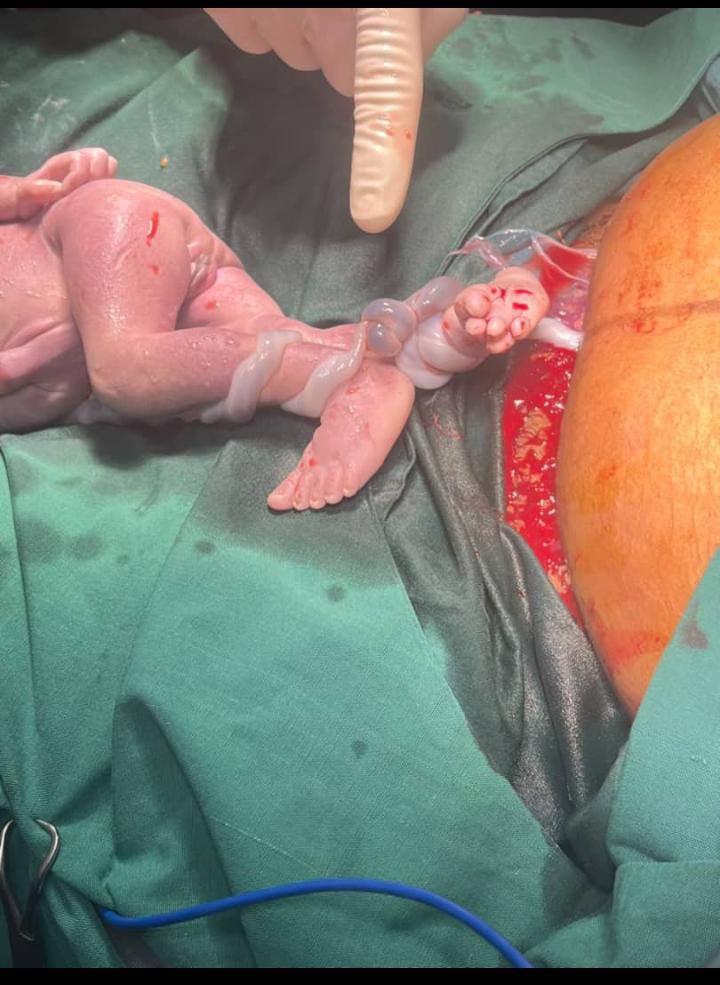 VictoriaDailyn's tweet photo. LET’S TALK ABOUT SCANS.

An ultrasound scan is NOT just for seeing your baby’s face, finding out the sex or taking a cute picture.

A pregnancy scan can give important information about the pregnancy, the baby, the placenta, amniotic fluid and more.

#Pregnancy #Ultrasound #AntenatalCare