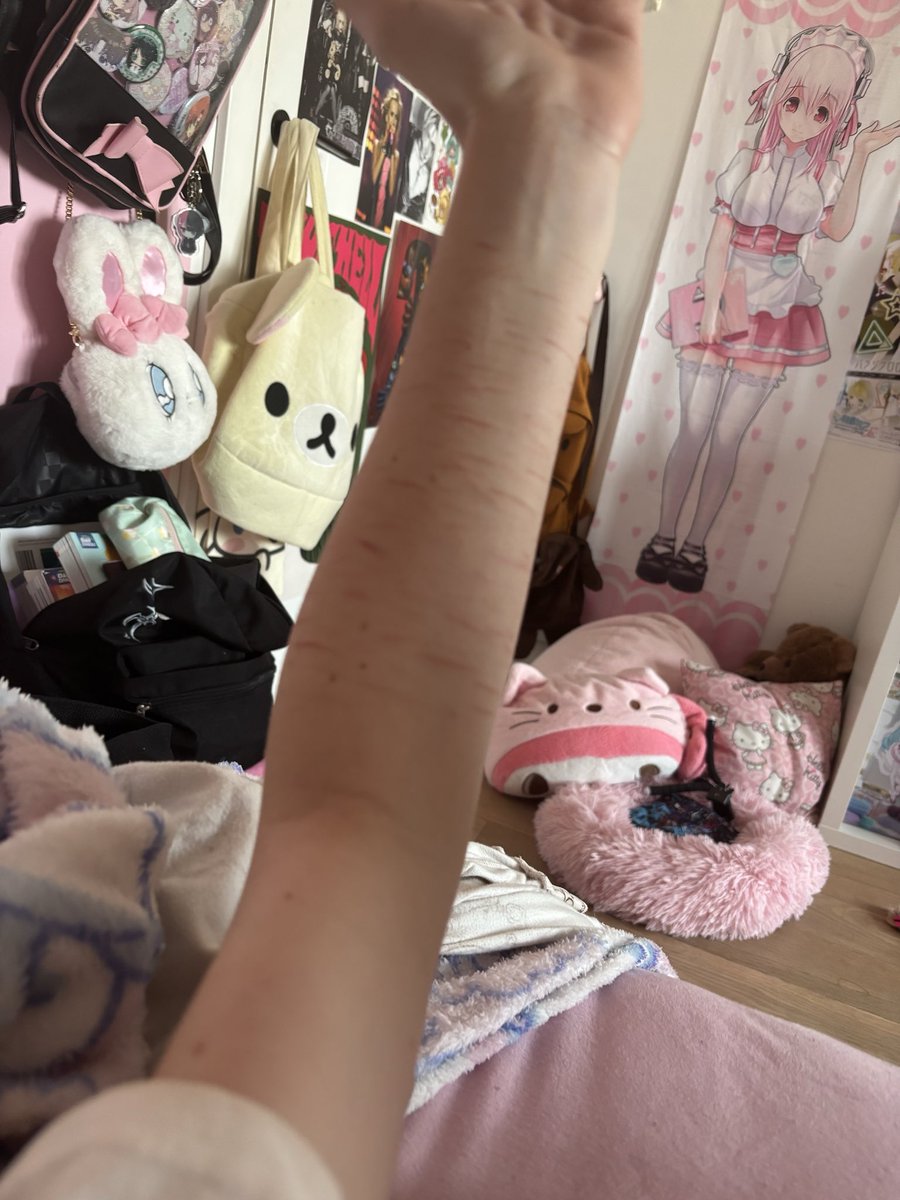 zzzzzbleh2's tweet photo. why does my arm look like that https://t.co/gbYjNMshAI