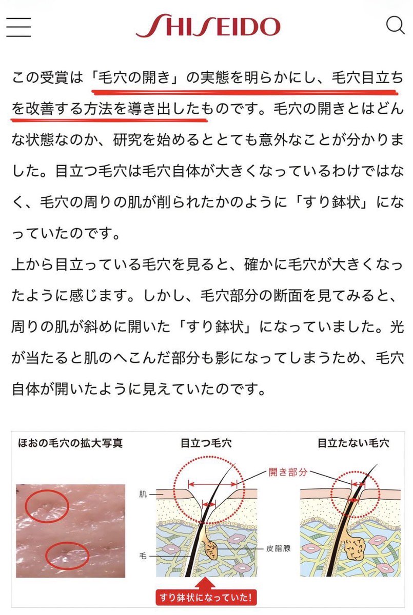 Ottoboke_'s tweet photo. この資生堂の研究で言われている通り、開き毛穴の原因は皮脂であることがほとんどで、グリシルグリシンで改善するって結果が出てる。

ただこの方の言ってる通り、刺激が強いから⬇️ https://t.co/0jYxtj0hhI