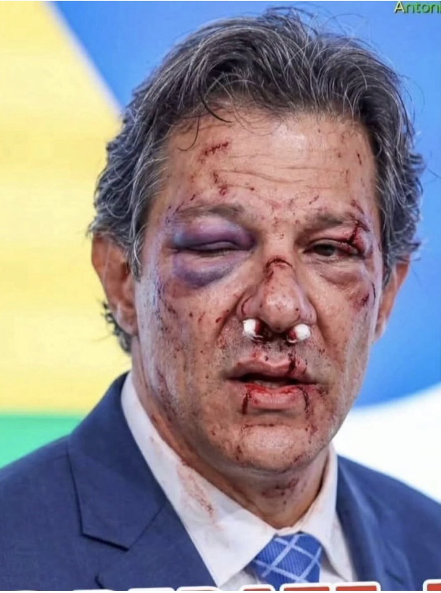 PauloBronca's tweet photo. Taxxad tomou muita porrada https://t.co/RTMaqsEh9w