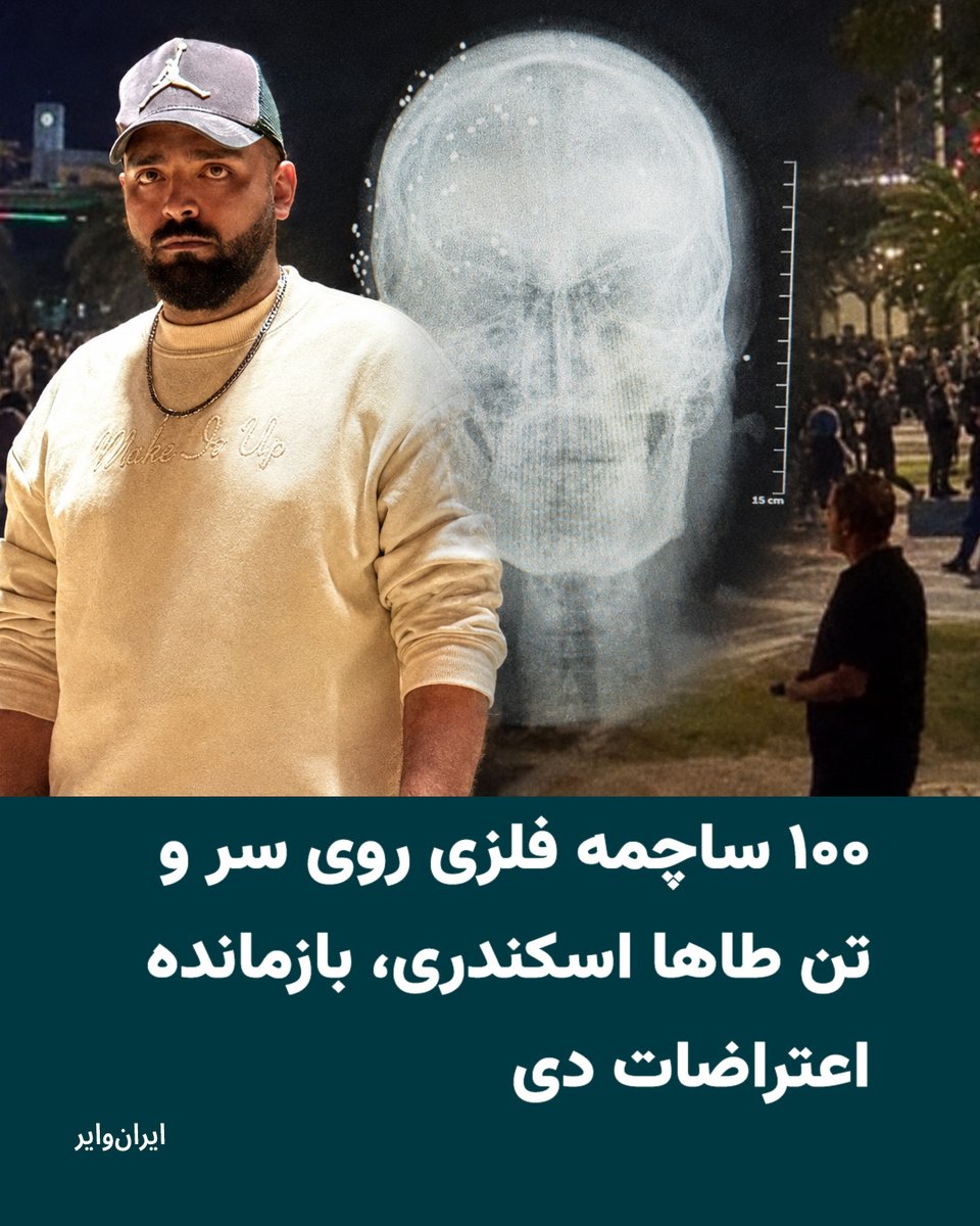 iranwire's tweet photo. طاها اسکندری به‌تازگی ۲۵ساله شده. او معترض اهل تهران است که برای کار در جزیره کیش ساکن بوده. طاها ۱۹دی‌ماه سه بار هدف گلوله ماموران سرکوب قرار می‌گیرد و حالا بیش از ۱۰۰ ساچمه فلزی در جمجمه، صورت، گردن و محدود ستون فقراتش دارد.
گزارش رقیه رضائی
https://t.co/gbRR9PnTar https://t.co/HxBwrb82qw