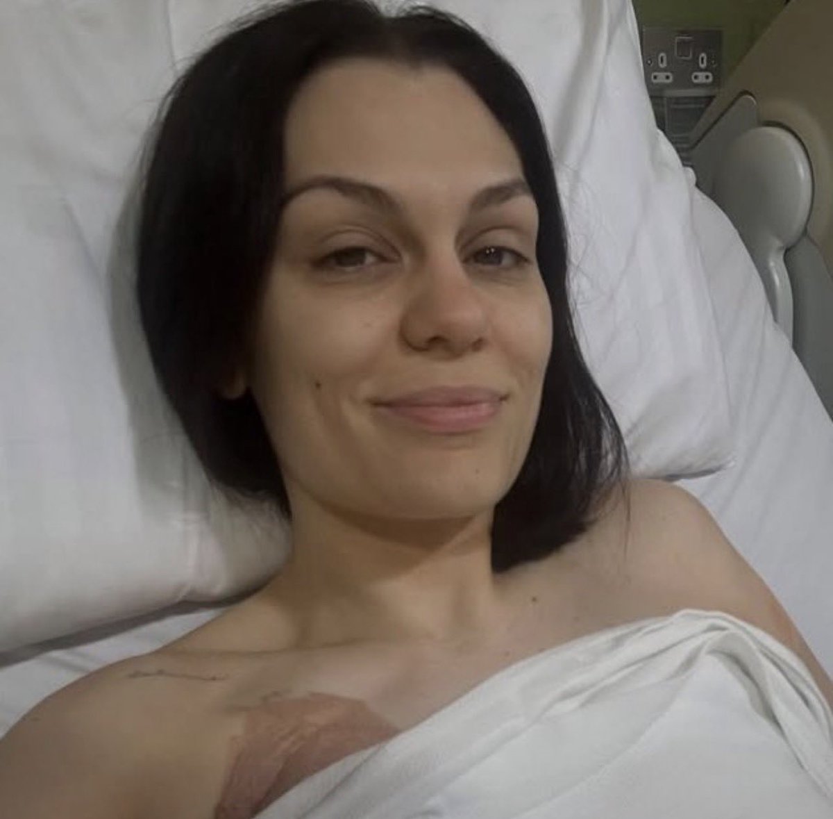 dukesurge's tweet photo. Jessie J has successfully underwent breast cancer removal surgery 🥳❤️‍🩹🎉 https://t.co/35kxwOThqh