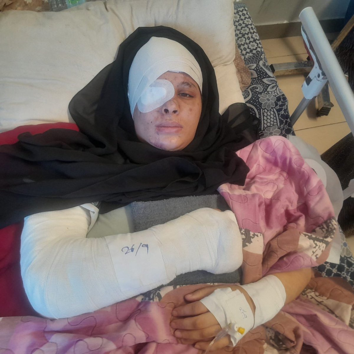 nowgnna's tweet photo. دينا مقداد.. ناجية من مجزرة إسرائيلية بعين مفقوءة وإصابات خطرة. https://t.co/47l7nxAjib