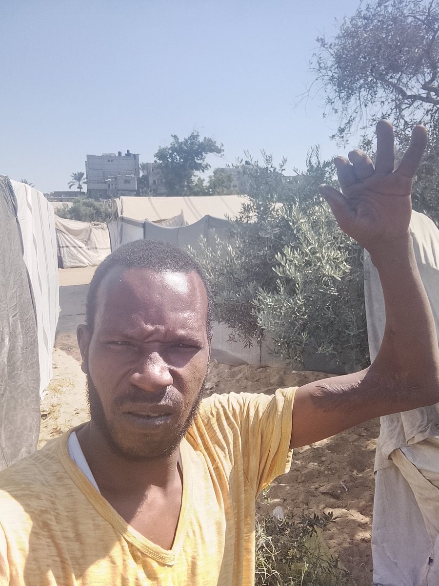 RamiUbaid97990's tweet photo. I am a black Palestinian 
Your donation helpsmeandmy familykeep trying to live andhelps us coverhousehold expenses.
Thankyoufrom thebottom of my heartfor everything
Donation,no matterhowsmall
“Freedom,justice,and equality for all—no room for racism.✊🏾⚖️🕊️
https://t.co/E7TbF8Pshx https://t.co/IqFphNxks1