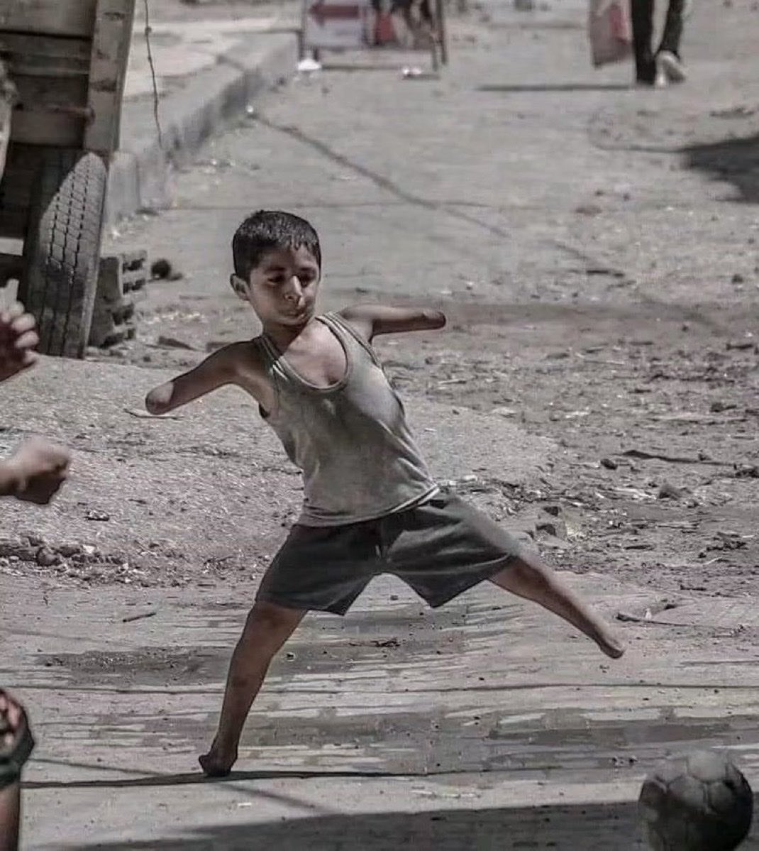 42ibrahimkarci's tweet photo. Elleri olmadan.. ama hayalini kaybetmedi.
Savaş kollarını aldı, ama ruhunu almadı.
Filistin, Gazze https://t.co/XgyS83O2Br