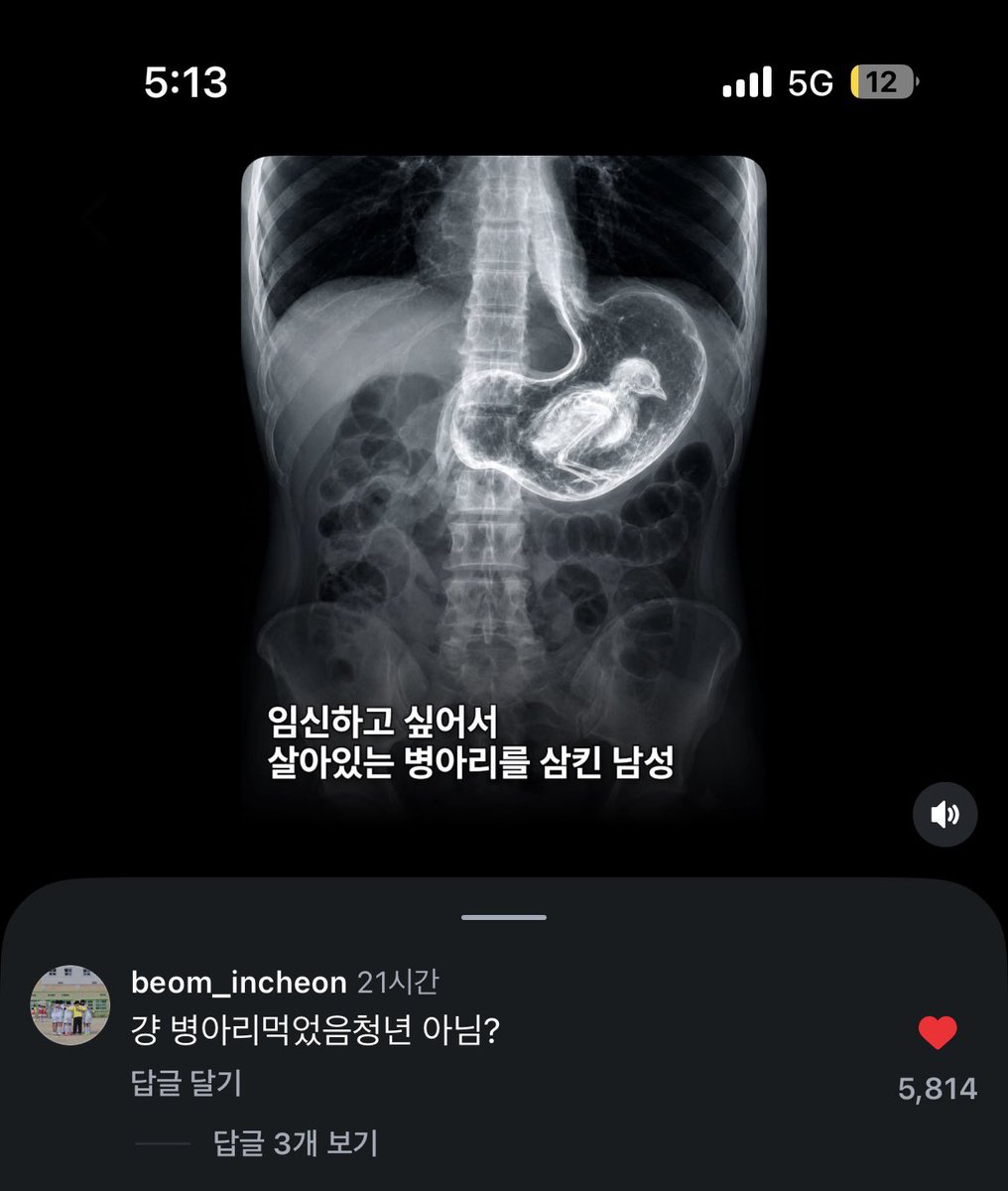 gsjwondbbsvm's tweet photo. 이년 존나골때리네 ㅆㅂ뭐래개웃기게 https://t.co/ZkL78EXiuC