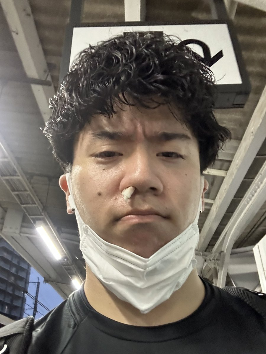 ganpro_sentaro's tweet photo. 人生2度目の鼻血🩸
急に出るからマジでびっくりするわ https://t.co/x7W2wHyY1x