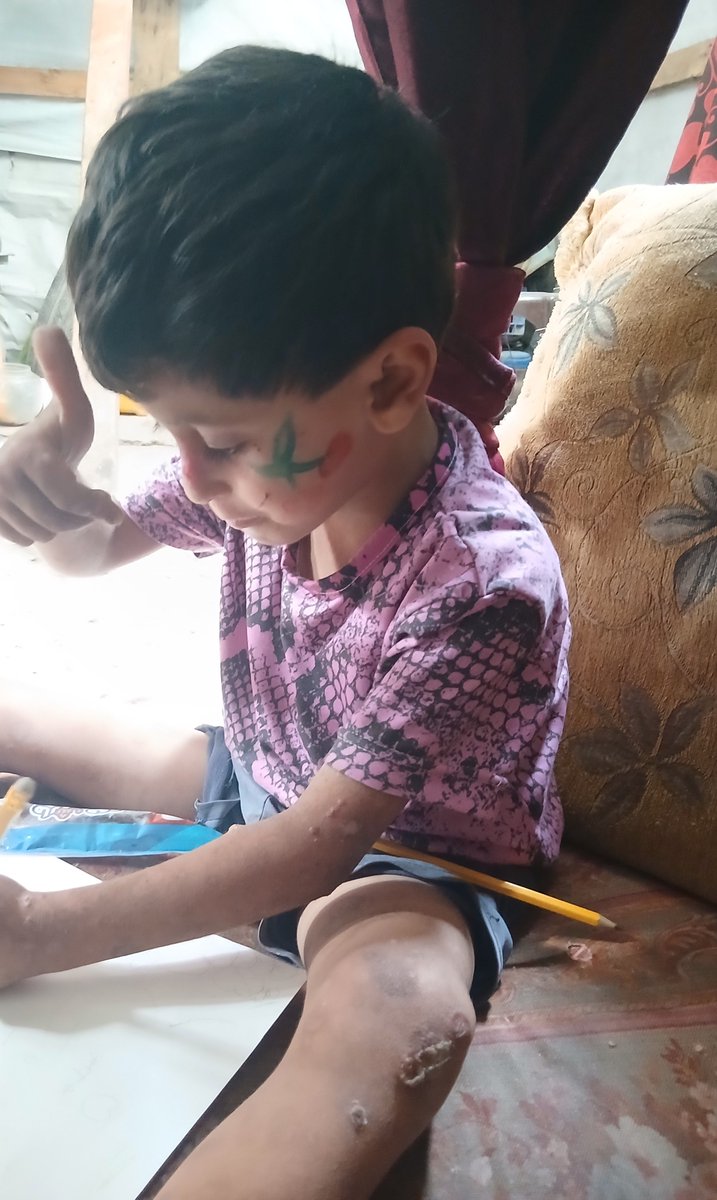 idz42t's tweet photo. 🥺 A small dream for Tiam… to go to kindergarten like other children.
We need your help to cover his kindergarten fees. 💙
Your donation or share could help make this dream come true. 🙏 https://t.co/wmBUnSScLK