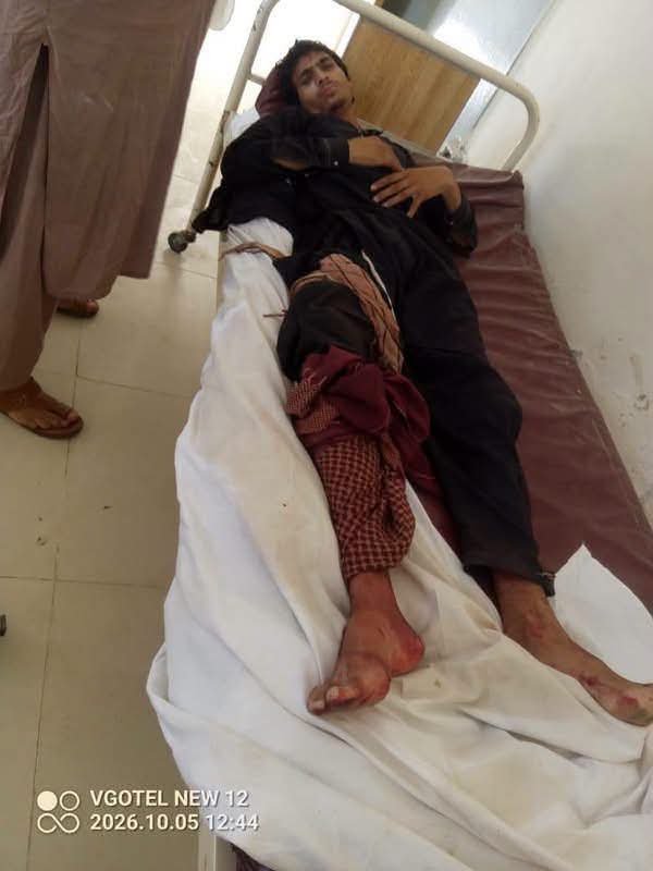 Alikhan18315's tweet photo. ظالم جابر اور وخشی ریاست  پاکستان نے شمالی وزیرستان کی تحصیل میرعلی کے گاؤں ناونہ میں کواڈ کاپٹر ڈرون سے بم گرا کر نتیجے میں 8 معصوم بچے شدید زخمی ہوئے ہیں۔ زخمی بچوں کو علاج کے لیے میرعلی ہسپتال منتقل کر دیا گیا ہے۔ زخمی بچوں کے لیے مختلف بلڈ گروپس کی اشد ضرورت ہے @umerpashtoon https://t.co/xJR1mtdnSq