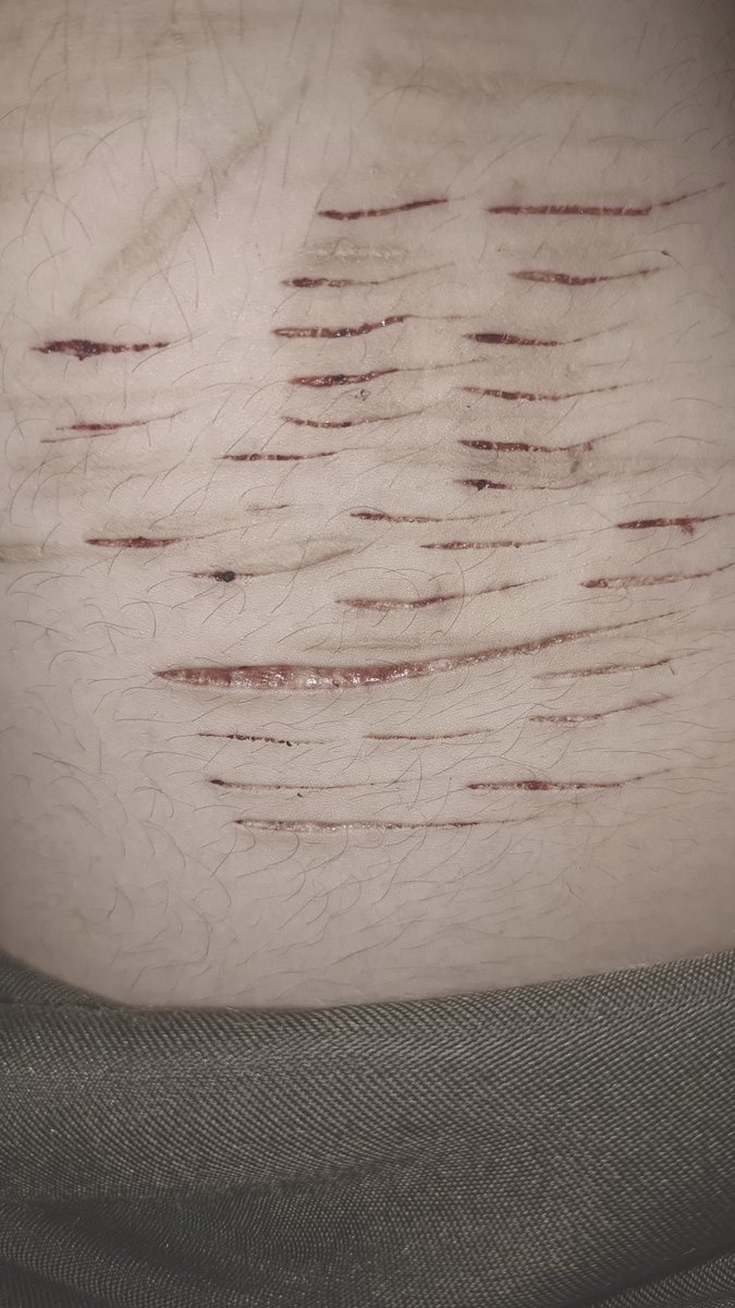 sl1tmeout's tweet photo. All fake, sfx halloween make-up ideas. Fake body 

My first styro.. Does this count as styro? 
#988twt #shhtwt #slittwt #shttwt https://t.co/HkQphBdT9W