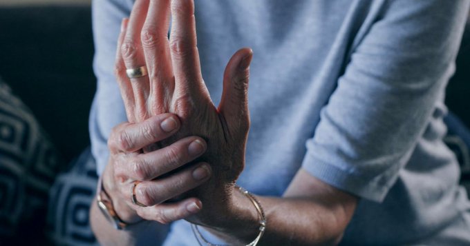 dr_alfonsovidal's tweet photo. 👉 Por qué el #dolor de la #artritisreumatoide persiste pese a conseguir bajar la #inflamación, según estudios, vía #latercera
✅ https://t.co/T6DGNUzxrV
#EquipoDrAlfonsoVidal #UnidadDelDolor #RechaceImitadores #SomosUnicos #EnAlcorcónDesde2002 @QuironSalud https://t.co/0TAg5pkr1I