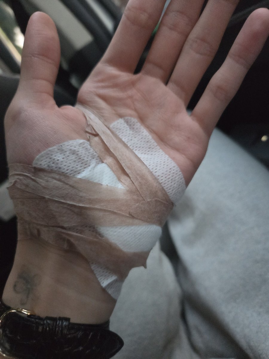 mepuppieyou's tweet photo. เจ็บตัวจริงๆด้วย 😭 แอนตันวิ่งตากฝนแล้วล้ม มือ เข่า สะโพก ข้อศอก เป็นแผลหมดเลย แต่น้องบอก don’t worry na ㅠㅠㅠㅠㅠ https://t.co/v4z6m6KP0K