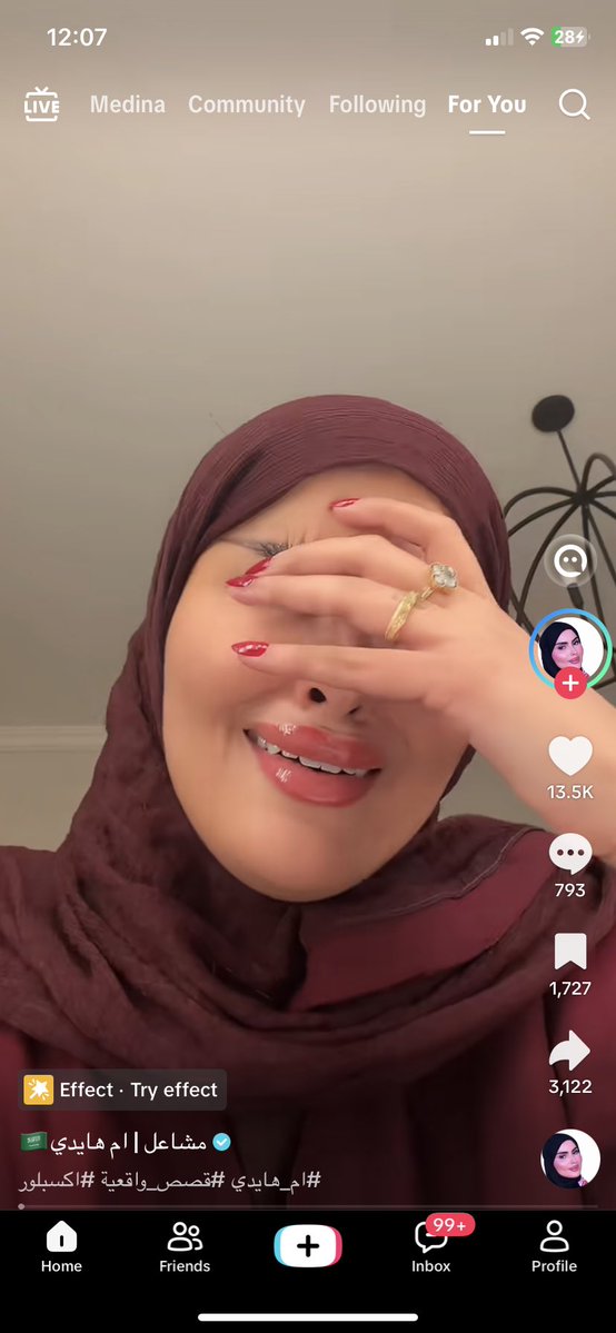 VAMPIREJEO's tweet photo. اموت وابغى افهم عديمة الانسانيه هذي يعني انتِ قاعده تهاجمين بنات مو قادرين يعيشون حياه طبيعيه زيك انتِ والسملق اللي واقفين معك تقول اذا اهلك يعنفونك وغاصبينك وقامعينك شدخلنا فيك؟ اي فعلًا شدخلك واقفه ضد التاق وحاشره خشمك بشي مايخصك وتصايحين غبيه جدًا غبيه #٢٠٣٠_بلا_نقاب5 https://t.co/BtRoCxtIU5