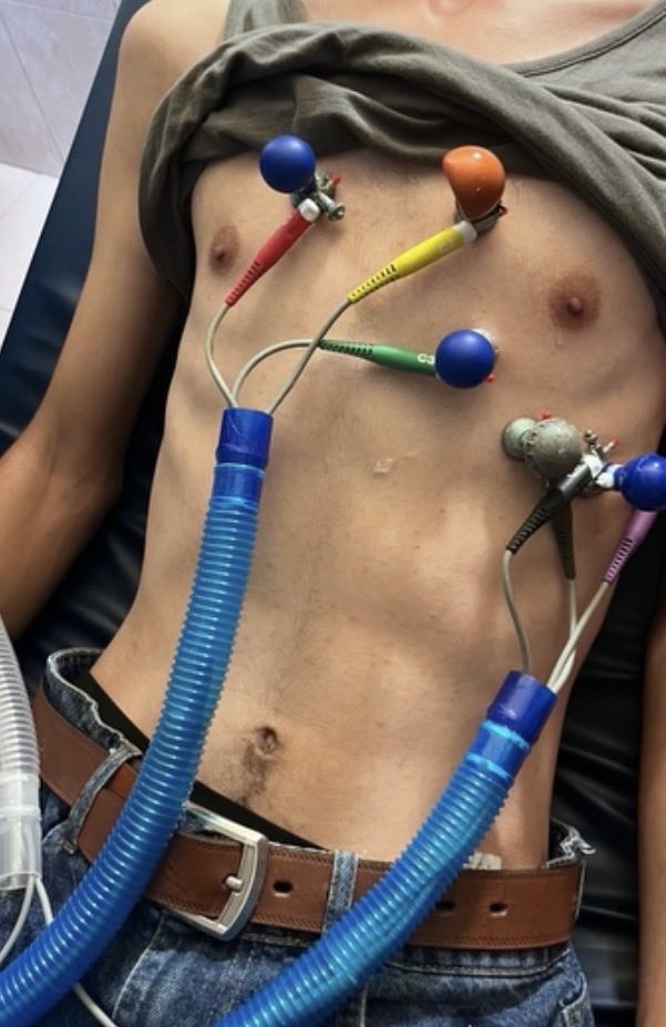 mohammed_m8_'s tweet photo. 🚨 I NEED $600 FOR MY SURGERY 🚨

Sadly, I have received no support so far, and I am still waiting and hoping that someone will stand beside me. 💔

I was injured during the war, and now I urgently need surgery. I am trying to collect $600 so I can receive the treatment I need and have a chance to recover.

Every dollar can help me get closer to my surgery.
$1, $5, $10 — every contribution matters. 🙏

If you cannot donate, please share my story. Every person who shares can help my voice reach someone who may be able to support me.

I am not asking for anything beyond what I need to get treatment. I just want the chance to take care of my injury and continue my life. 🤍

Please, stand beside me.
Please help me reach $600.

I need your help for my life.
I need your help to have my surgery.
Please don’t leave me alone. 💔🇵🇸🙏

https://t.co/lJ5rkkshUI