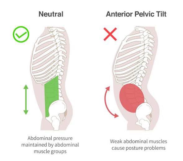 bosswoozibaby's tweet photo. no anterior pelvic tilt - that’s just how big the woobs are 😭😭😭😭😭 https://t.co/MKjMFHi5op