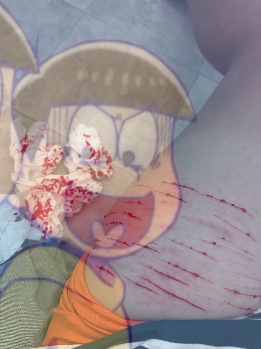 sl33py_al3x2002's tweet photo. Pre shower sesh + thighs the following morning

!! FAKE !! HALLOWEEN SFX - MAKEUP PRACTICE !

#sh #shtwt https://t.co/FE9wJzsI4x