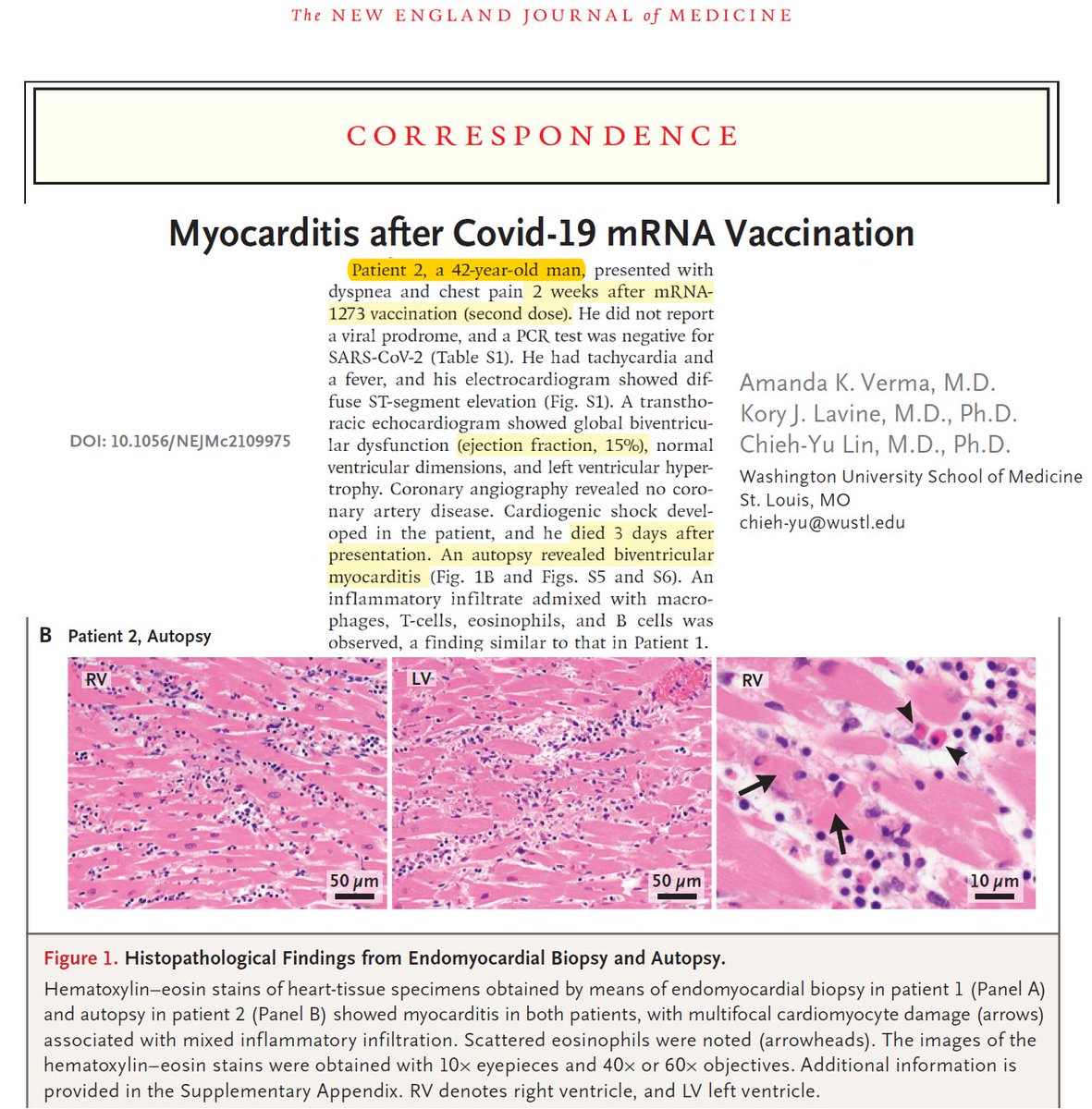 P_McCulloughMD's tweet photo. Myocarditis can be fatal.  Each shot was another gamble with life for Roberts.  @johnrobertsFox https://t.co/UH9kQkNwAb