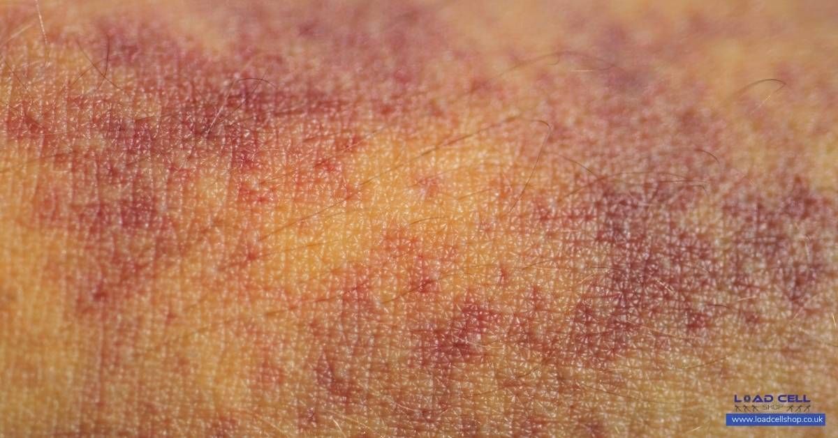 Load_Cell_Shop's tweet photo. Skin can endure more than you might think. Researchers using load cells found injury only occurs beyond 75% compression. 
Discover how science measures resilience: 
https://t.co/BEMLAeF26O

#MaterialScience #SkinResearch #LoadCells https://t.co/lCAaavd2hy