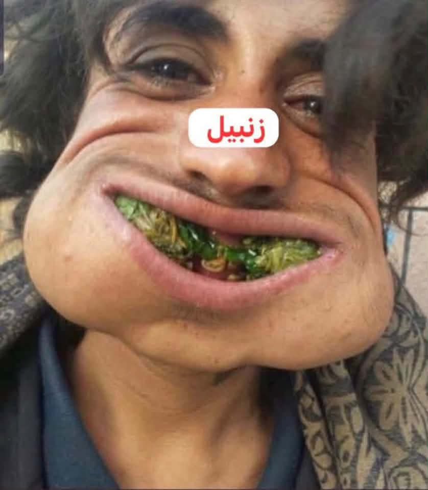 Ahmadddd1wr's tweet photo. @0dGi4 @4vdxu @IRIMFA_AR @KSAMOFA وهذه صوره اخوك الزنبيل الثاني هههههههه 🤣🤣🤣😂🤣 https://t.co/1Tb8pjBc6L