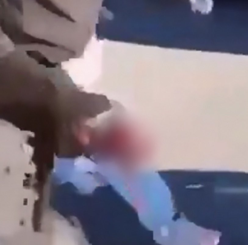 Brevesdepresse's tweet photo. 🔴🇫🇷ALERTE - À #Lens, un ado de 15 ans a eu la main arrachée dans l’explosion d’une grenade tirée par la police. «J’ai vu sa main exploser. Il ne l’a pas ramassée, il l’a reçue sur lui», témoigne une lycéenne à la radio Ici. Certaines sources évoquent une blessure jusqu’au coude. https://t.co/ihNAiFjTpk